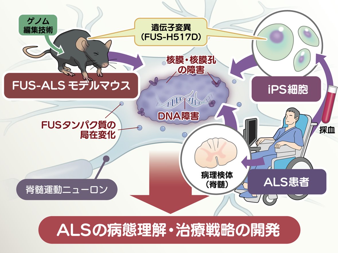筋萎縮性側索硬化症における新規治療ターゲット、核膜・核膜孔障害の発見