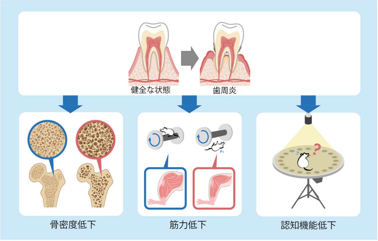歯周病が引き起こす多臓器のフレイル～炎症性老化による全身への影響を解明～