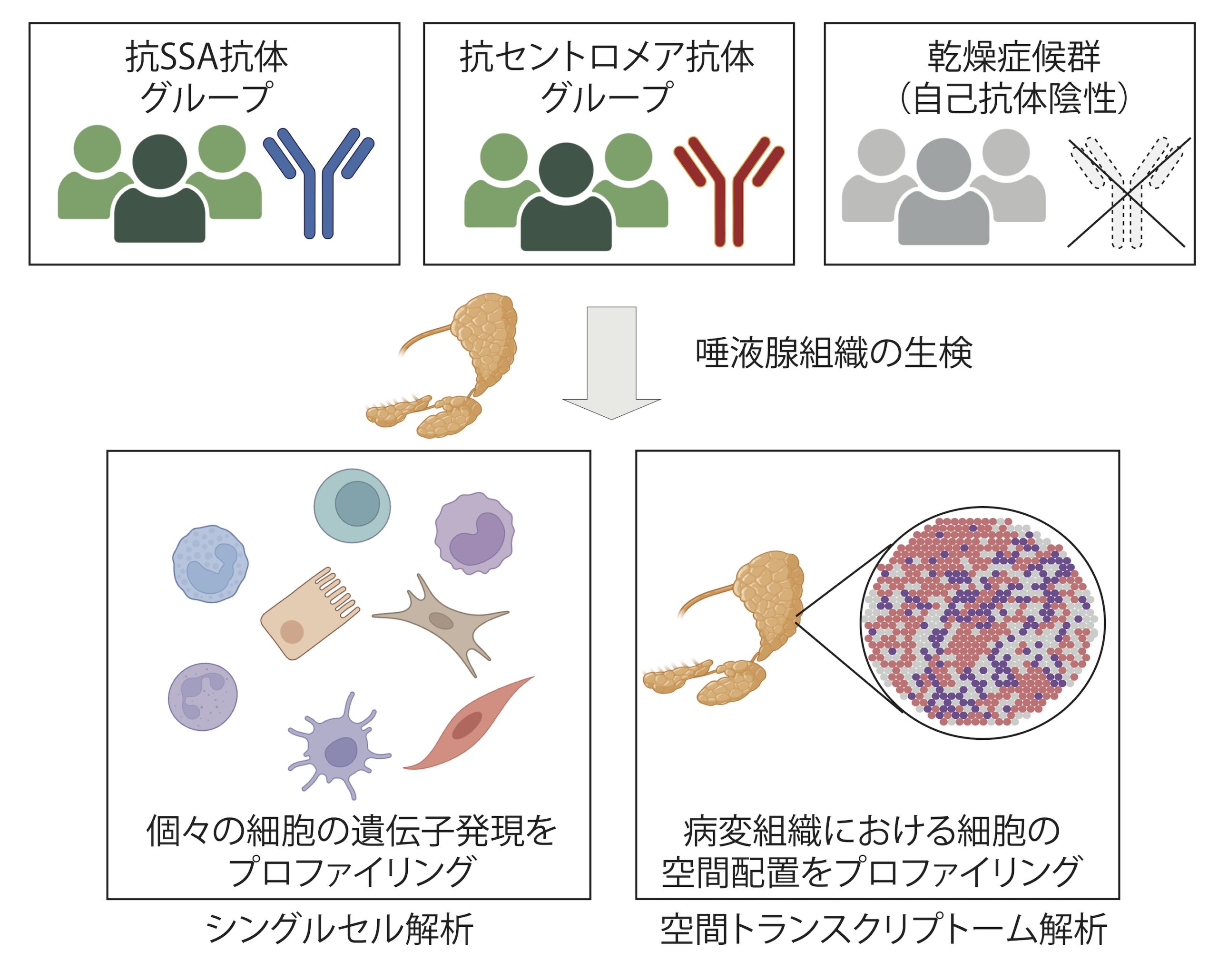 1細胞解析で迫る、シェーグレン病の多様な病態