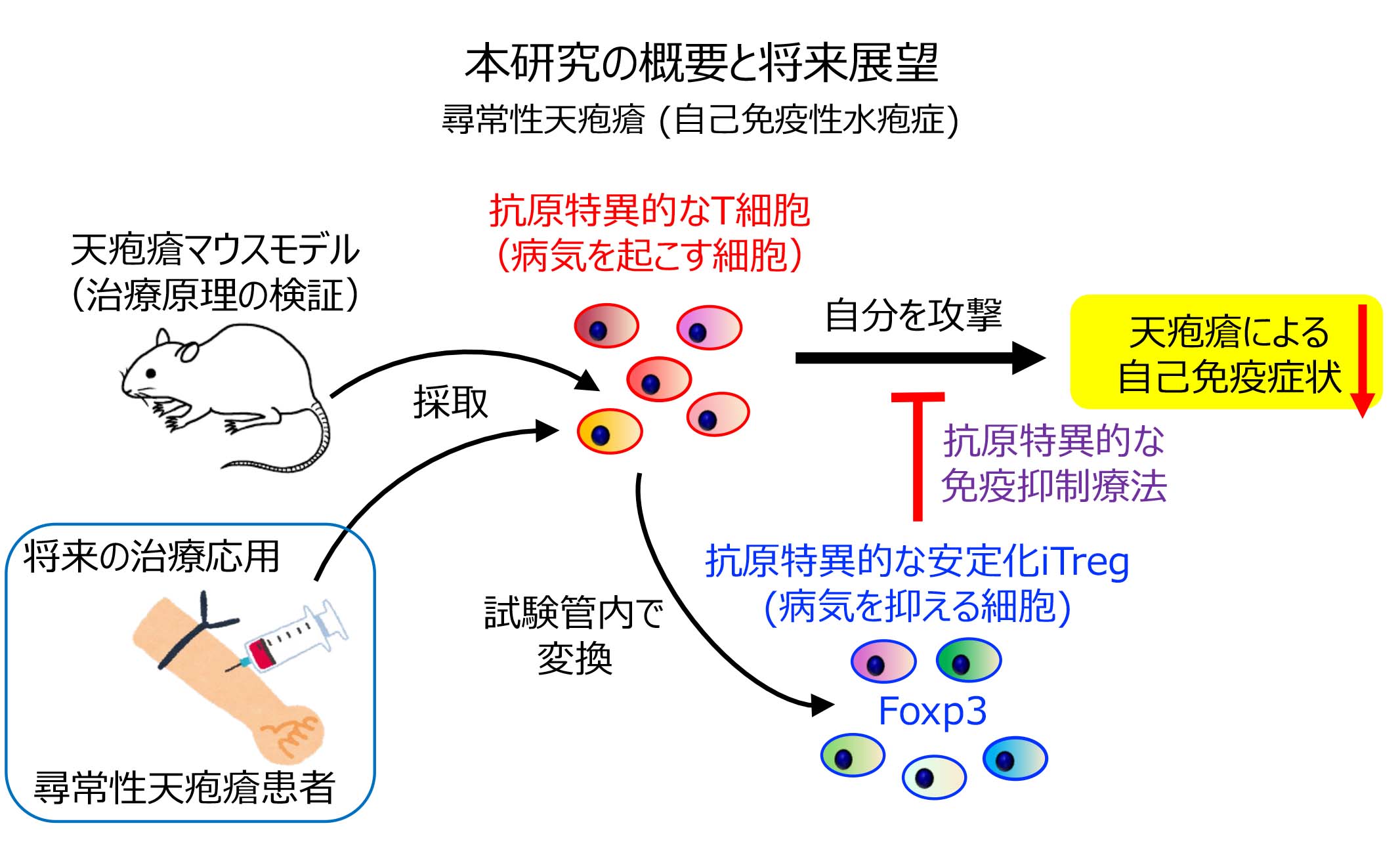 尋常性天疱瘡に対する抗原特異的治療の開発