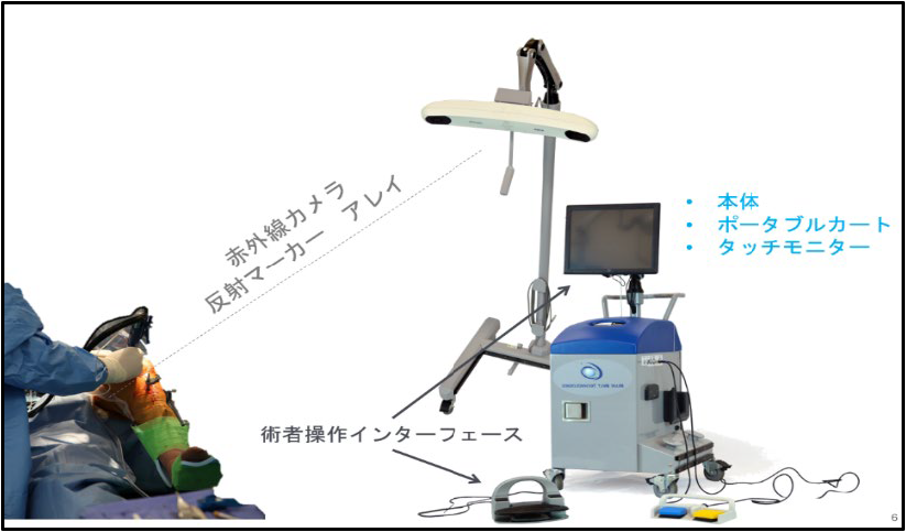整形外科におけるロボット手術―ロボット支援下人工膝関節置換術